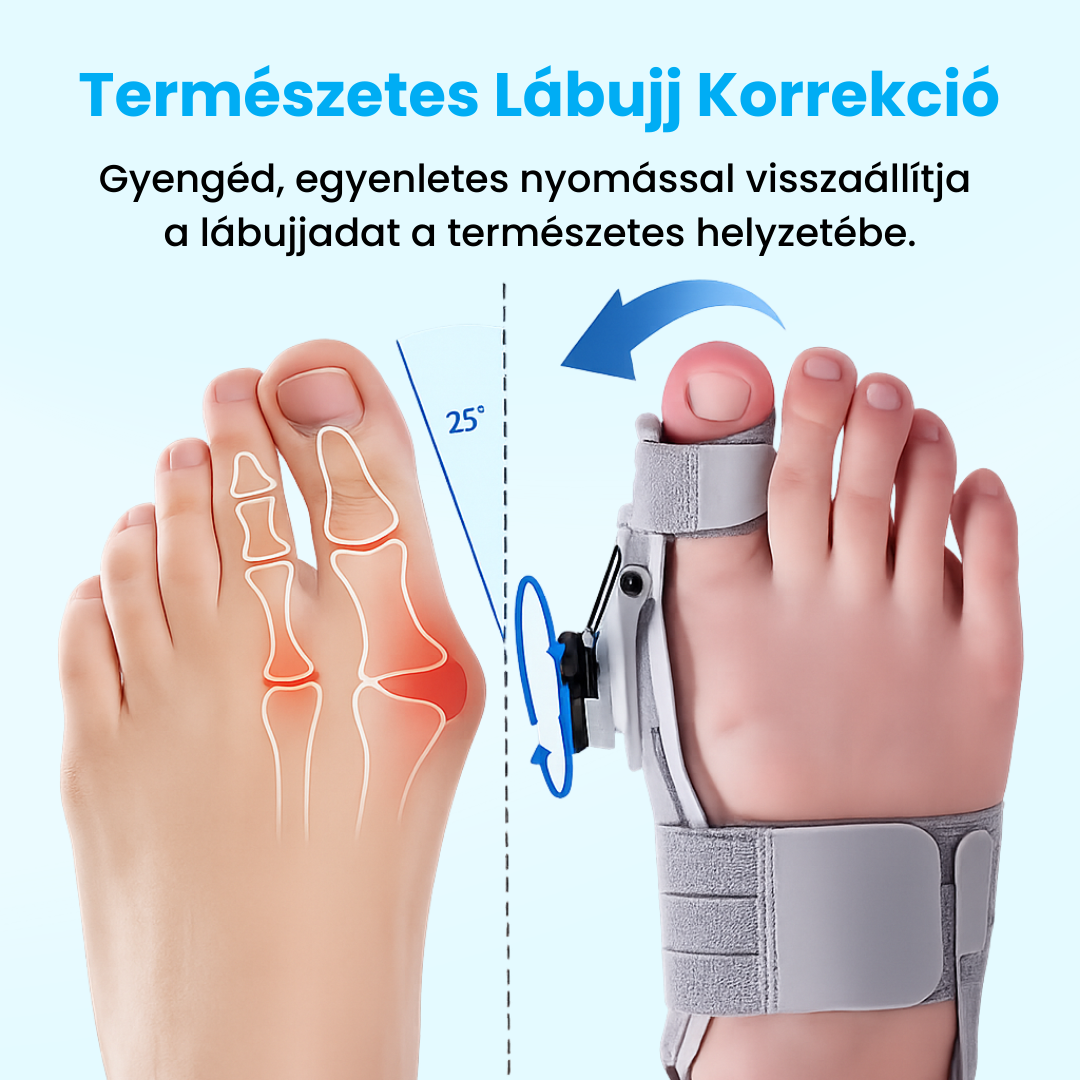 BütyökDoktor - Bütyök Korrigáló