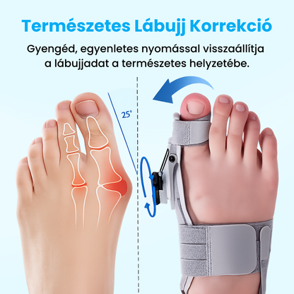 BütyökDoktor - Bütyök Korrigáló