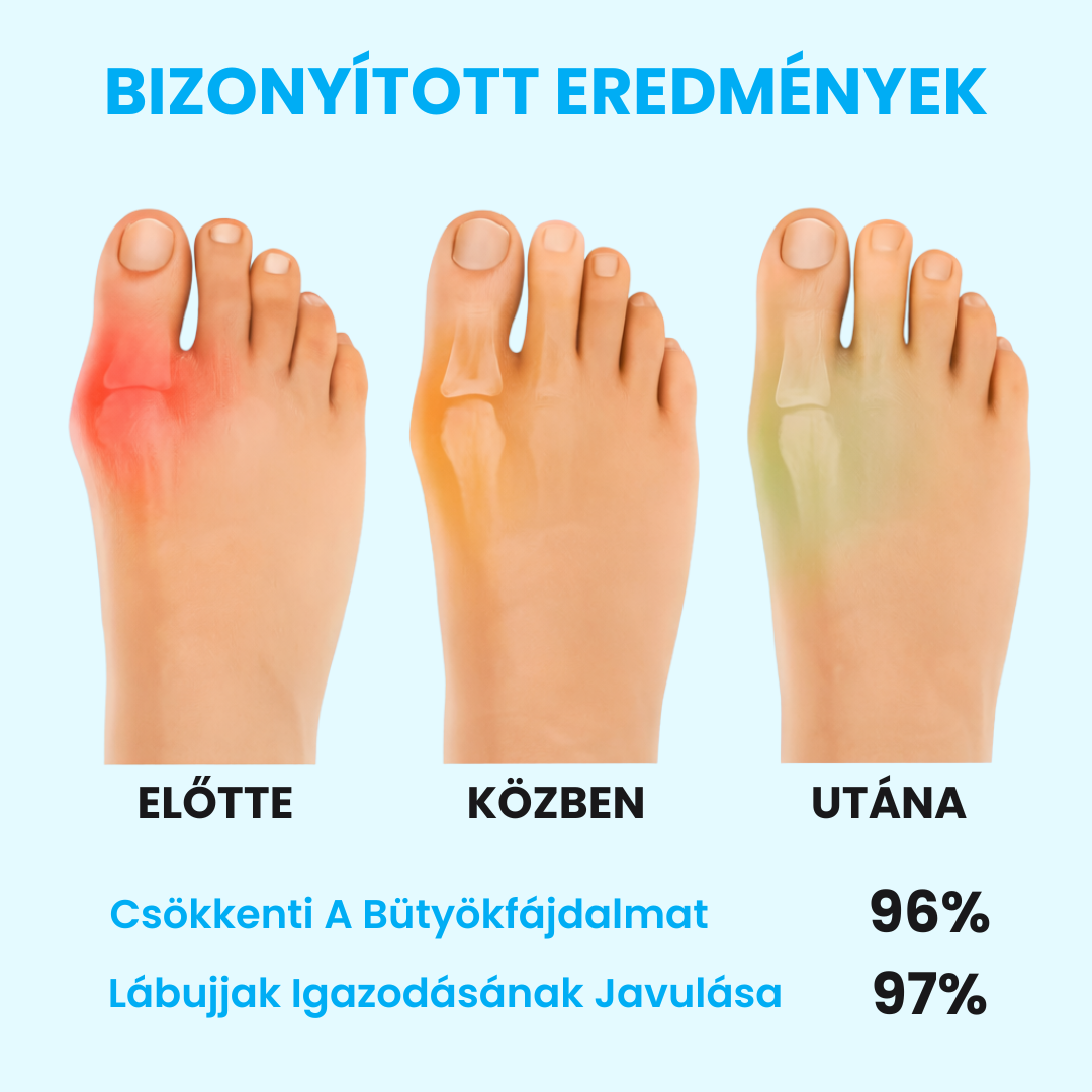 BütyökDoktor - Bütyök Korrigáló